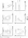 Fig. 12 - Hybrid feature-driven learning system for abnormality detection and localization