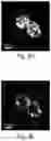 Fig. 09 - SUB-DIFFRACTION LIMIT IMAGE RESOLUTION IN THREE DIMENSIONS