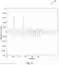 Fig. 10 - Methods and system for processing an EMG signal