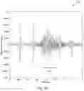 Fig. 11 - Methods and system for processing an EMG signal