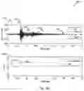 Fig. 12 - Methods and system for processing an EMG signal