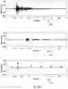 Fig. 13 - Methods and system for processing an EMG signal