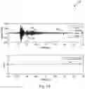 Fig. 14 - Methods and system for processing an EMG signal