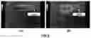 Fig. 04 - DUAL IMAGE SYSTEM SUITABLE FOR ONCOLOGICAL DIAGNOSES AND REAL TIME GUIDED BIOPSIES