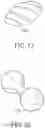 Fig. 06 - INTRAGASTRIC DEVICE WITH EXPANDABLE PORTIONS