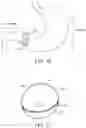 Fig. 08 - INTRAGASTRIC DEVICE WITH EXPANDABLE PORTIONS