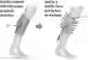 Fig. 01 - Soft exosuit for assistance with human motion