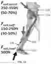 Fig. 22 - Soft exosuit for assistance with human motion
