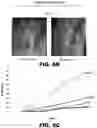 Fig. 10 - INHIBITORS OF DNA PK AND USES THEREOF