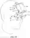 Fig. 15 - Head mounted display with lens