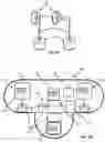 Fig. 05 - Detachable mini-camera device