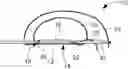 Fig. 01 - Suture and soft anchor assembly and method of making the same