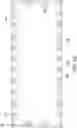 Fig. 11 - Semiconductor device