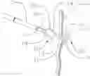 Fig. 01 - Wire Hook
