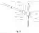 Fig. 06 - Wire Hook