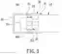 Fig. 04 - Miniature Endoscope