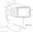 Fig. 02 - Methods and apparatuses for compensating for retinitis pigmentosa