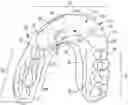 Fig. 01 - Mouth Guard