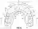 Fig. 03 - Mouth Guard