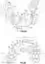 Fig. 04 - Mouth Guard