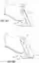 Fig. 08 - Embedded blade cutters and blades for same