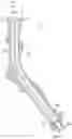 Fig. 02 - Running tool and method of cleaning a downhole well casing