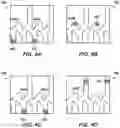 Fig. 10 - Apparatus and method for abrasive perforating and clean-out