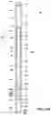 Fig. 20 - Apparatus and method for abrasive perforating and clean-out