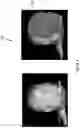 Fig. 04 - Obscuring facial features of a subject in an image