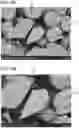 Fig. 17 - Positive electrode for nonaqueous secondary battery, method for forming the same, nonaqueous secondary battery, and electrical device