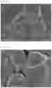 Fig. 08 - POSITIVE ELECTRODE ACTIVE SUBSTANCE PARTICLES COMPRISING LITHIUM NICKELATE COMPOSITE OXIDE, AND NON-AQUEOUS ELECTROLYTE SECONDARY BATTERY