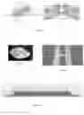Fig. 06 - Antenna
