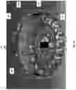 Fig. 02 - Electric machine, tuned winding geometry and technology and related methods