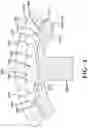 Fig. 06 - Acoustic noise mitigation system for an electric machine