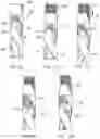 Fig. 09 - Injection apparatus