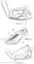 Fig. 04 - Golf irons with sealed undercut