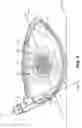 Fig. 06 - Mixed material golf club head