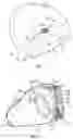 Fig. 05 - Golf club head having stress-reducing features