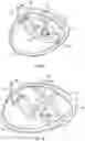 Fig. 08 - Golf club head having stress-reducing features