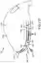 Fig. 68 - Adjustable weight club head