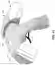Fig. 37 - Grappling dummy