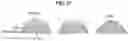 Fig. 12 - Fabrication and applications of multiple side-window, side-firing optical fiber