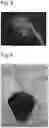Fig. 04 - Method for introducing substance into plant