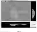 Fig. 05 - Disposable towel produced with large volume surface depressions