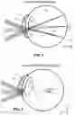 Fig. 04 - Dynamic eye fixation for retinal imaging