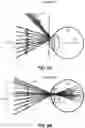 Fig. 08 - Dynamic eye fixation for retinal imaging