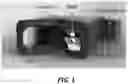 Fig. 02 - Smartphone-based digital pupillometer