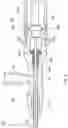 Fig. 05 - Image diagnosis catheter