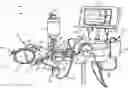Fig. 01 - Fluid pressure sensor protection
