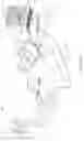 Fig. 02 - Brain aneurysm tool with a wire deflection mechanism
